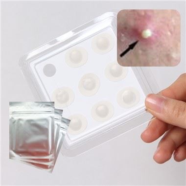 Лепенки за петна от акне